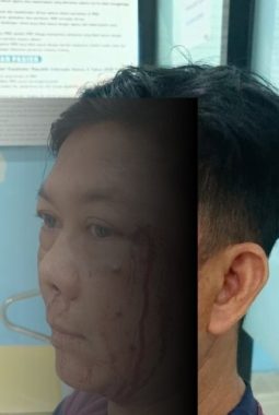 Diduga Persoalan Ayam dan Parkir Berujung Pengeroyokan di Pangkalan Bun